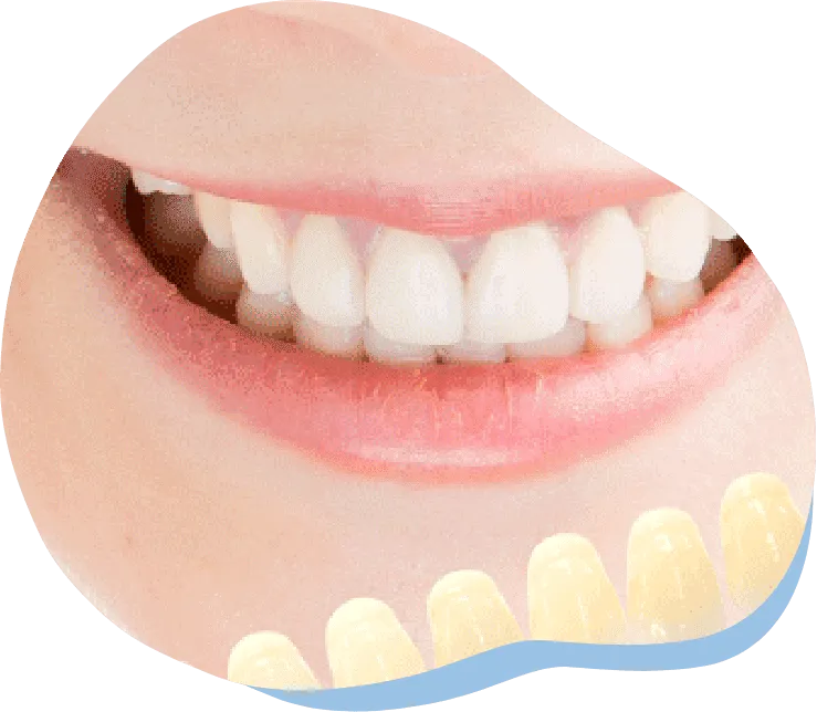 イメージ画像